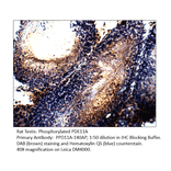 Anti-Phospho-PDE11A Antibody (S117) from FabGennix (PPD11A-140AP) - Antibodies.com