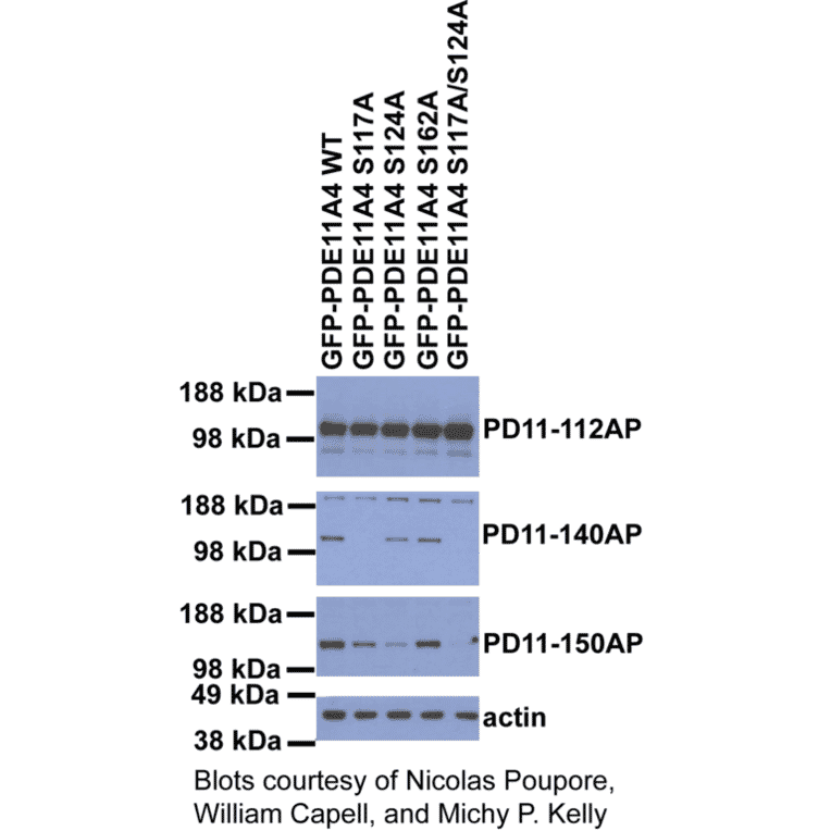 Anti-Phospho-PDE11A Antibody (S117) from FabGennix (PPD11A-140AP) - Antibodies.com