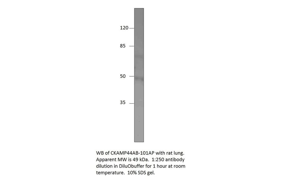 Anti-SHISA9 isoform X2 Antibody from FabGennix (CKAMP44AB-112AP) - Antibodies.com