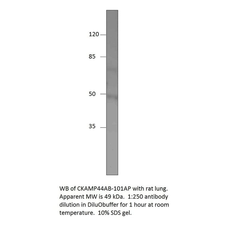 Anti-SHISA9 isoform X2 Antibody from FabGennix (CKAMP44AB-112AP) - Antibodies.com