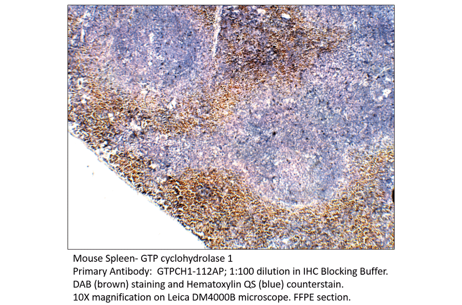 Anti-GTP cyclohydrolase 1 Antibody from FabGennix (GTPCH1-112AP) - Antibodies.com