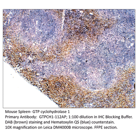 Anti-GTP cyclohydrolase 1 Antibody from FabGennix (GTPCH1-112AP) - Antibodies.com