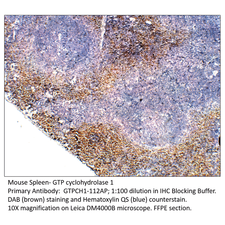 Anti-GTP cyclohydrolase 1 Antibody from FabGennix (GTPCH1-112AP) - Antibodies.com