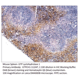 Anti-GTP cyclohydrolase 1 Antibody from FabGennix (GTPCH1-112AP) - Antibodies.com