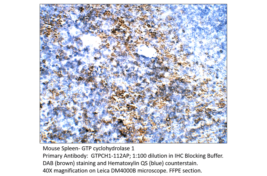 Anti-GTP cyclohydrolase 1 Antibody from FabGennix (GTPCH1-112AP) - Antibodies.com