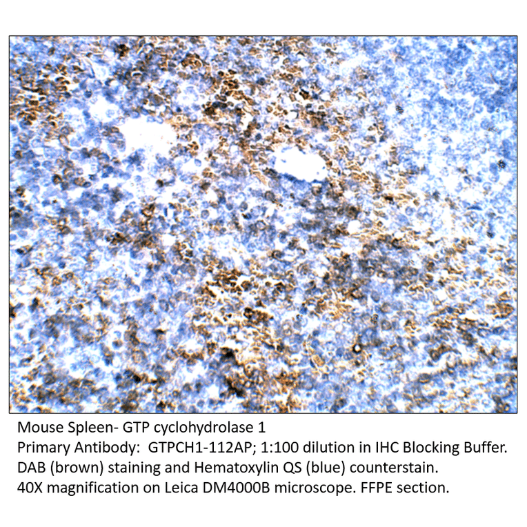 Anti-GTP cyclohydrolase 1 Antibody from FabGennix (GTPCH1-112AP) - Antibodies.com