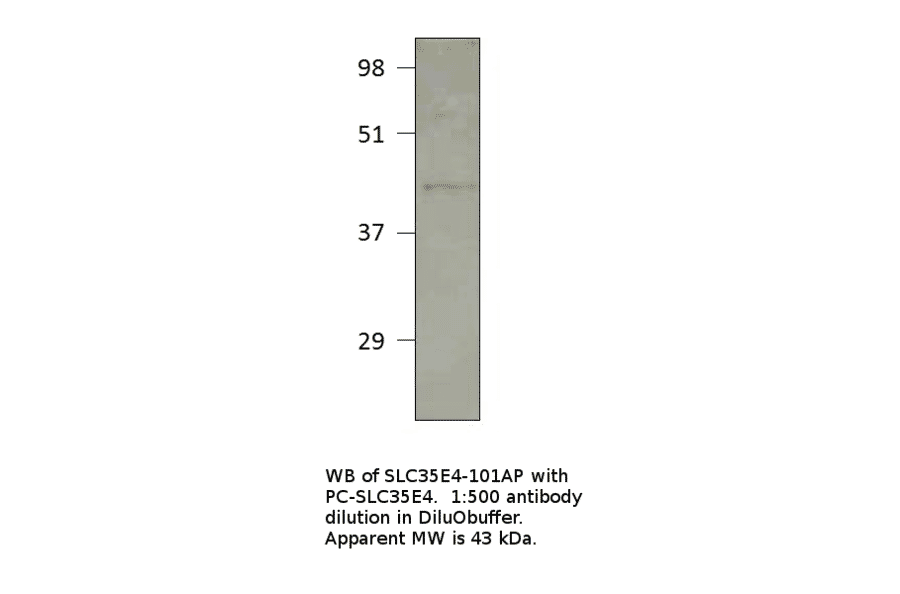 Anti-Solute carrier family 35 member E4 Antibody from FabGennix (SLC35E4-101AP) - Antibodies.com