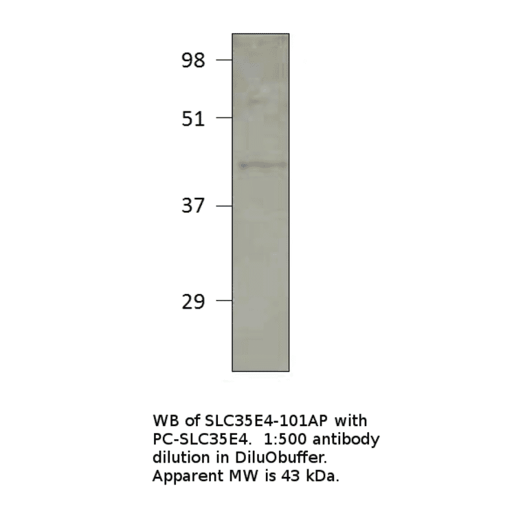 Anti-Solute carrier family 35 member E4 Antibody from FabGennix (SLC35E4-101AP) - Antibodies.com