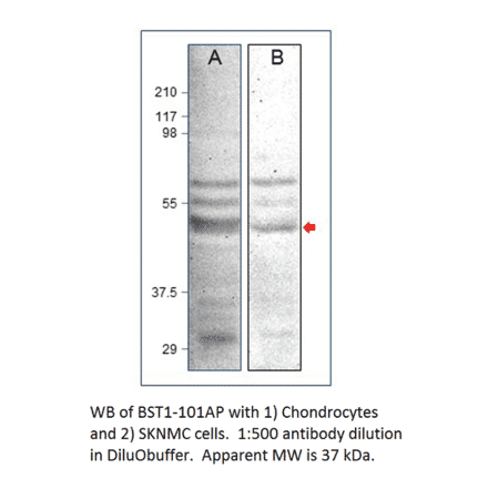Anti-Bone marrow stromal cell antigen 1 Antibody from FabGennix (BST1-101AP) - Antibodies.com