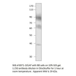 Anti-Bone marrow stromal cell antigen 1 Antibody from FabGennix (BST1-101AP) - Antibodies.com