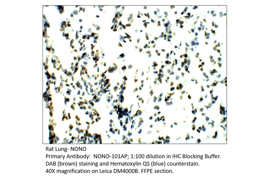 Anti-nmt55 / NONO / p54nrb Antibody from FabGennix (NONO-101AP) - Antibodies.com