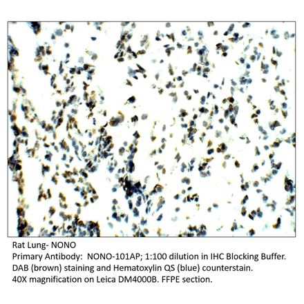 Anti-nmt55 / NONO / p54nrb Antibody from FabGennix (NONO-101AP) - Antibodies.com