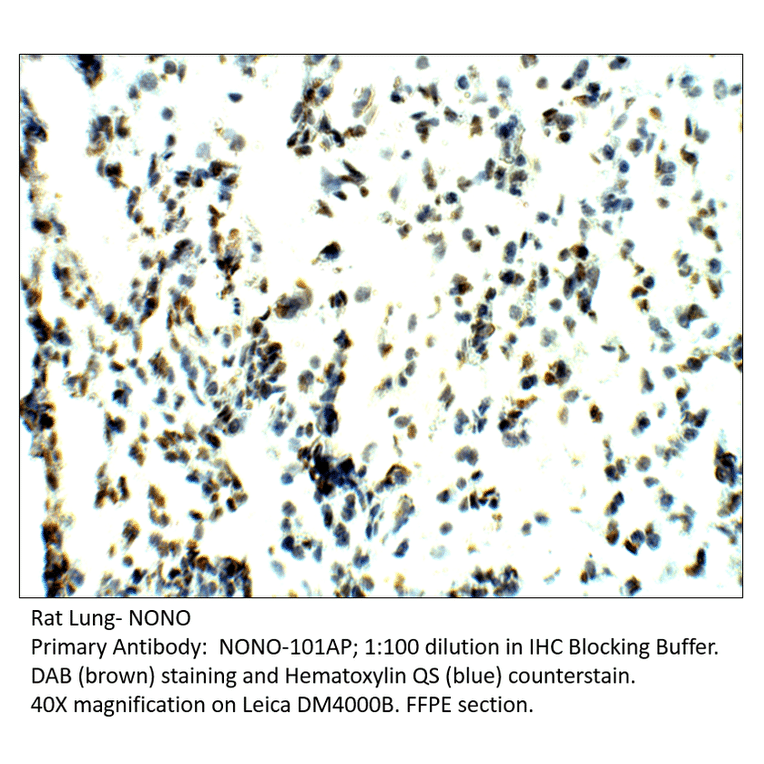 Anti-nmt55 / NONO / p54nrb Antibody from FabGennix (NONO-101AP) - Antibodies.com