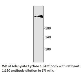Anti-Adenylate Cyclase 10 Antibody from FabGennix (SAC10-101AP) - Antibodies.com