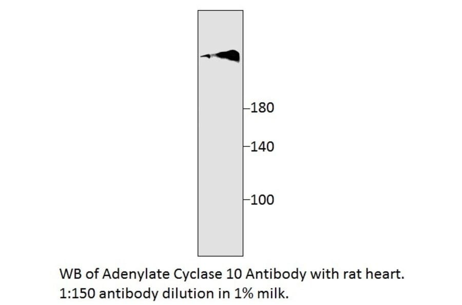 Anti-Adenylate Cyclase 10 Antibody from FabGennix (SAC10-101AP) - Antibodies.com