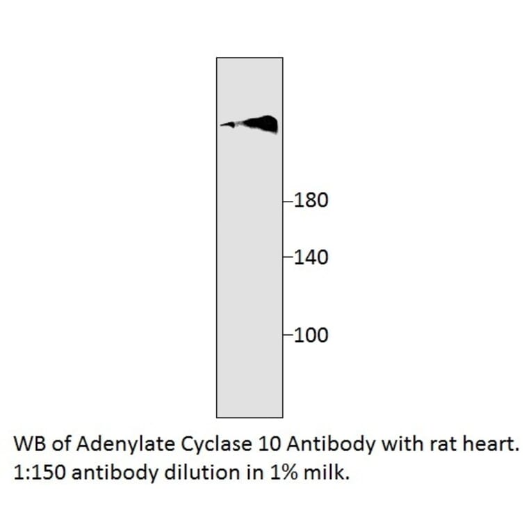 Anti-Adenylate Cyclase 10 Antibody from FabGennix (SAC10-101AP) - Antibodies.com