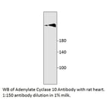 Anti-Adenylate Cyclase 10 Antibody from FabGennix (SAC10-101AP) - Antibodies.com