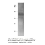 Anti-Adenine Nucleotide Translocator 2 Antibody from FabGennix (ANT2-201AP) - Antibodies.com