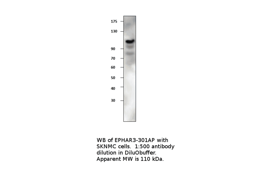 Anti-Ephrin Receptor A3 Antibody from FabGennix (EPHAR3-301AP) - Antibodies.com