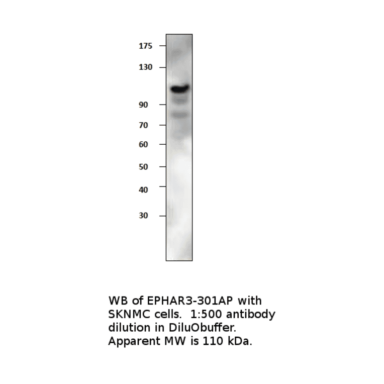 Anti-Ephrin Receptor A3 Antibody from FabGennix (EPHAR3-301AP) - Antibodies.com