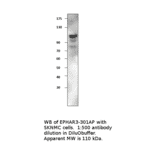 Anti-Ephrin Receptor A3 Antibody from FabGennix (EPHAR3-301AP) - Antibodies.com