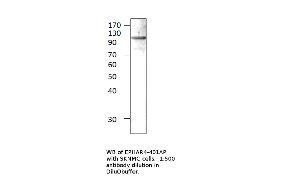 Anti-Ephrin Receptor A4 Antibody from FabGennix (EPHAR4-401AP) - Antibodies.com