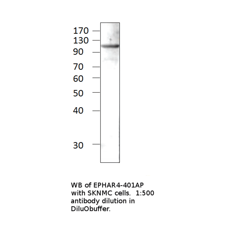 Anti-Ephrin Receptor A4 Antibody from FabGennix (EPHAR4-401AP) - Antibodies.com