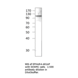 Anti-Ephrin Receptor A4 Antibody from FabGennix (EPHAR4-401AP) - Antibodies.com