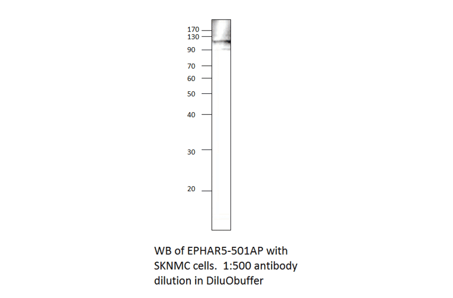 Anti-Ephrin Receptor A5 Antibody from FabGennix (EPHAR5-501AP) - Antibodies.com