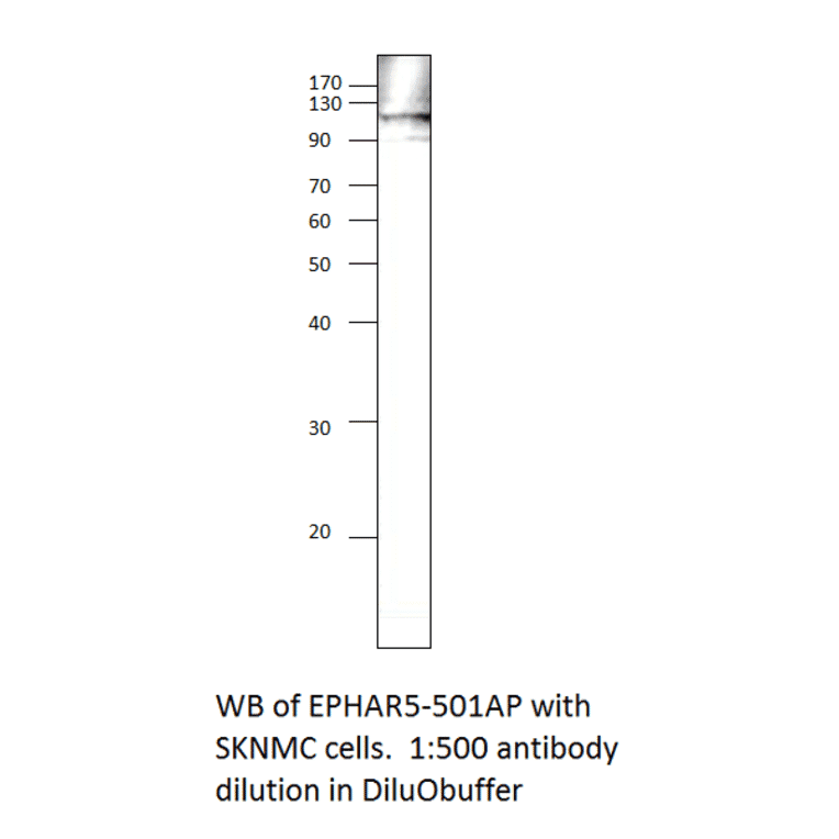Anti-Ephrin Receptor A5 Antibody from FabGennix (EPHAR5-501AP) - Antibodies.com