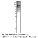 Anti-Ephrin Receptor A7 Antibody from FabGennix (EPHAR7-701AP) - Antibodies.com