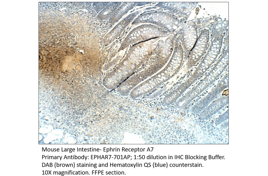 Anti-Ephrin Receptor A7 Antibody from FabGennix (EPHAR7-701AP) - Antibodies.com