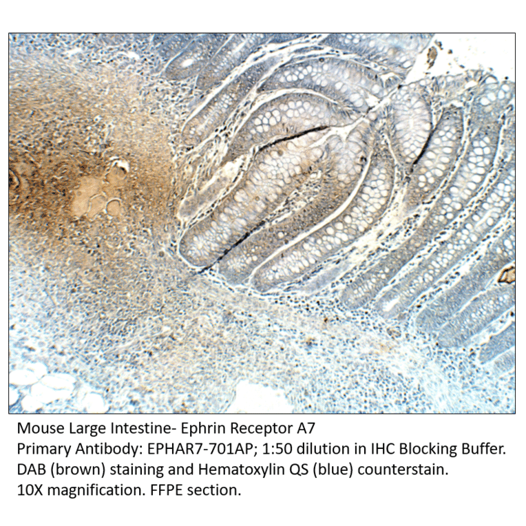 Anti-Ephrin Receptor A7 Antibody from FabGennix (EPHAR7-701AP) - Antibodies.com