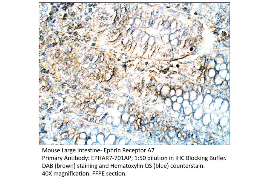 Anti-Ephrin Receptor A7 Antibody from FabGennix (EPHAR7-701AP) - Antibodies.com