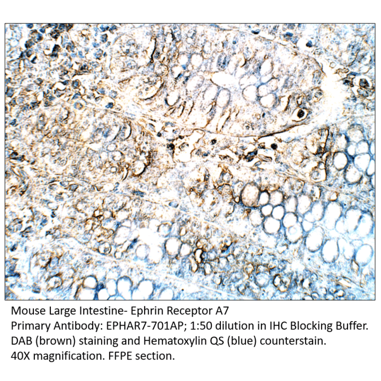Anti-Ephrin Receptor A7 Antibody from FabGennix (EPHAR7-701AP) - Antibodies.com