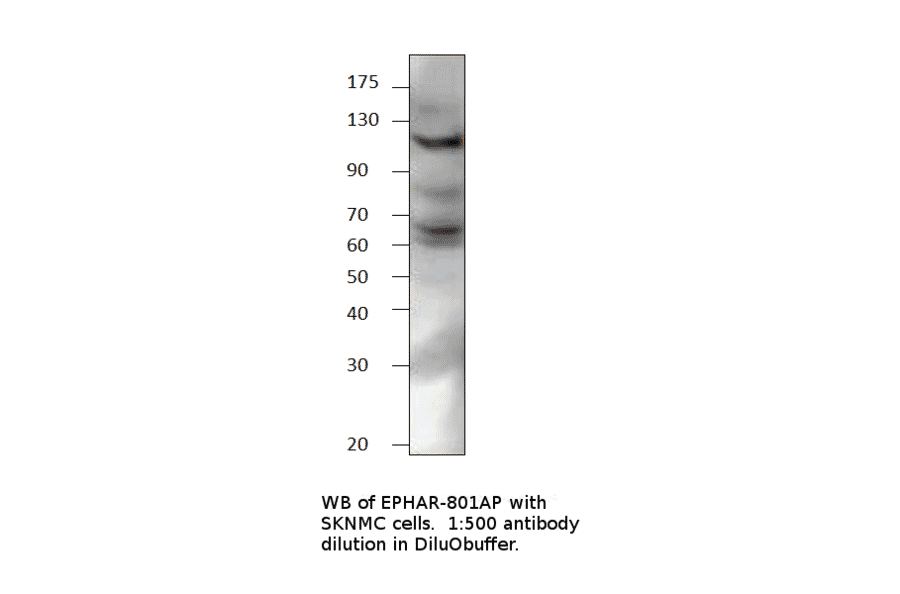 Anti-Ephrin Receptor A8 Antibody from FabGennix (EPHAR8-801AP) - Antibodies.com