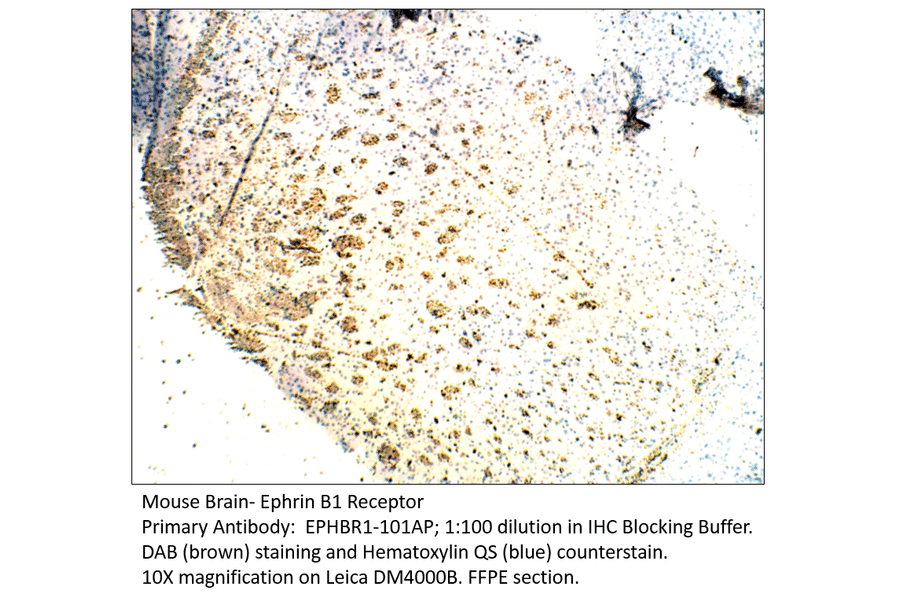 Anti-Ephrin Receptor B1 Antibody from FabGennix (EPHBR1-101AP) - Antibodies.com