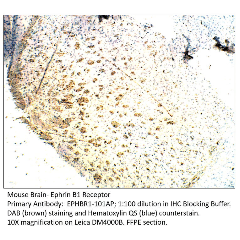 Anti-Ephrin Receptor B1 Antibody from FabGennix (EPHBR1-101AP) - Antibodies.com