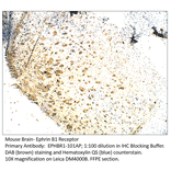 Anti-Ephrin Receptor B1 Antibody from FabGennix (EPHBR1-101AP) - Antibodies.com