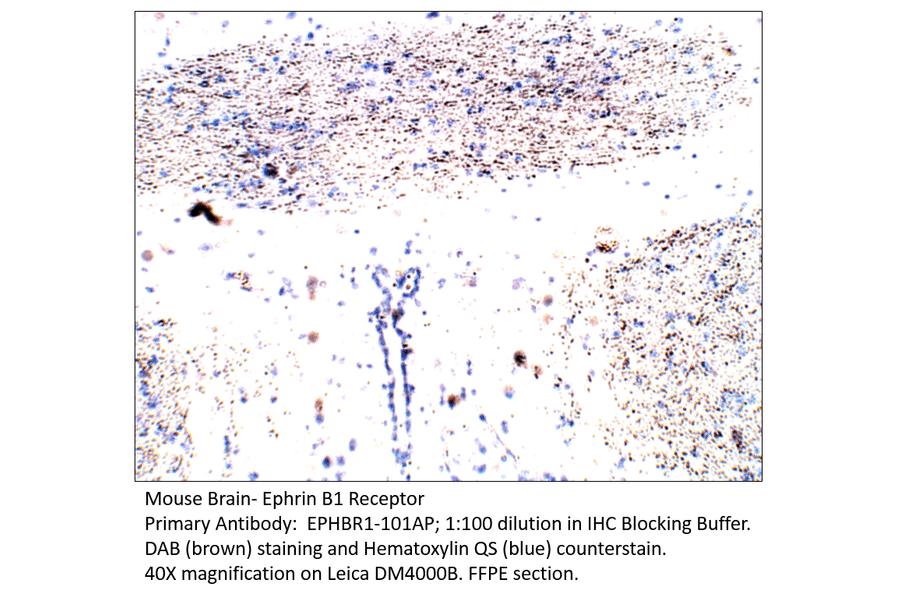 Anti-Ephrin Receptor B1 Antibody from FabGennix (EPHBR1-101AP) - Antibodies.com
