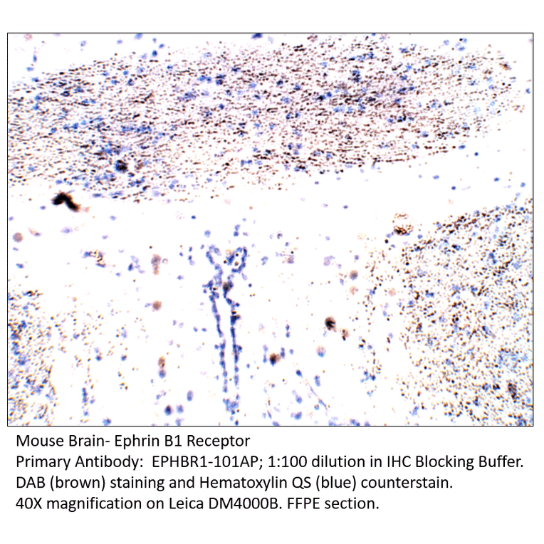Anti-Ephrin Receptor B1 Antibody from FabGennix (EPHBR1-101AP) - Antibodies.com