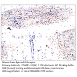 Anti-Ephrin Receptor B1 Antibody from FabGennix (EPHBR1-101AP) - Antibodies.com
