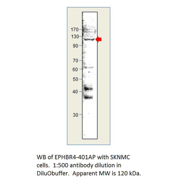 Anti-Ephrin Receptor B4 Antibody from FabGennix (EPHBR4-401AP) - Antibodies.com