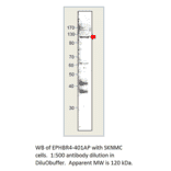Anti-Ephrin Receptor B4 Antibody from FabGennix (EPHBR4-401AP) - Antibodies.com