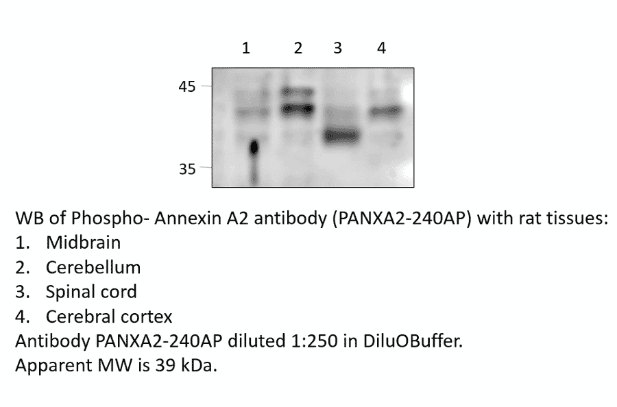 Anti-Phospho-Annexin A2 Antibody from FabGennix (PANXA2-240AP) - Antibodies.com