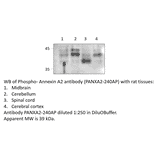 Anti-Phospho-Annexin A2 Antibody from FabGennix (PANXA2-240AP) - Antibodies.com