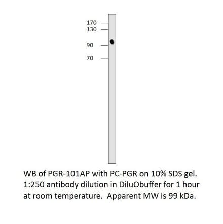 Anti-Progesterone Receptor Antibody from FabGennix (PGR-101AP) - Antibodies.com