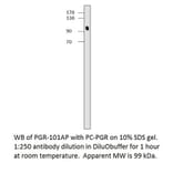 Anti-Progesterone Receptor Antibody from FabGennix (PGR-101AP) - Antibodies.com
