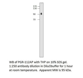 Anti-Progesterone Receptor Antibody from FabGennix (PGR-112AP) - Antibodies.com