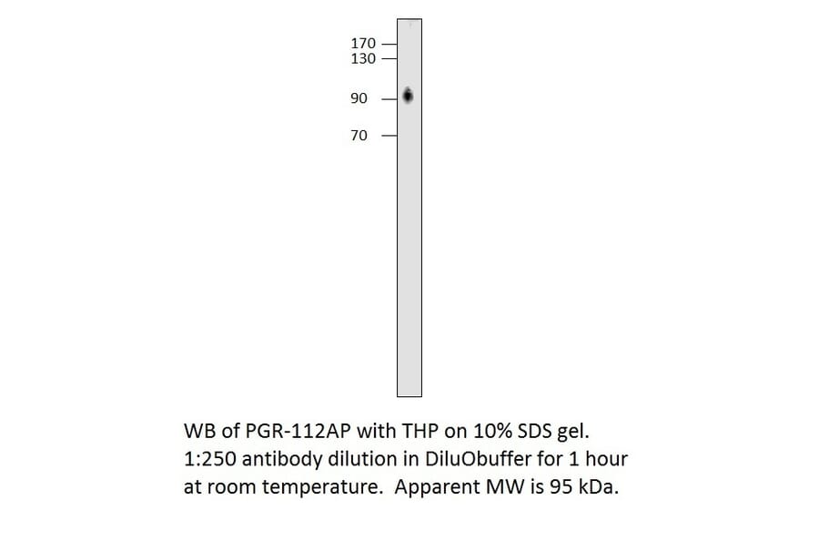 Anti-Progesterone Receptor Antibody from FabGennix (PGR-112AP) - Antibodies.com